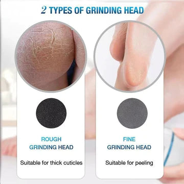 Electric Foot Grinder - Callus Remover